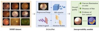 Enhancing the ophthalmic AI assessment with a fundus image quality classifier using local and global attention mechanisms